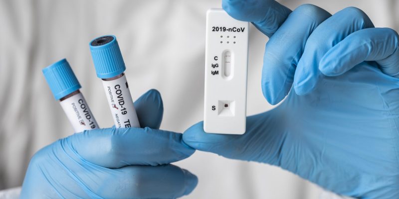 hand-with-protective-gloves-holding-blood-samples-covid-test hand-with-protective-gloves-holding-blood-samples-covid-test