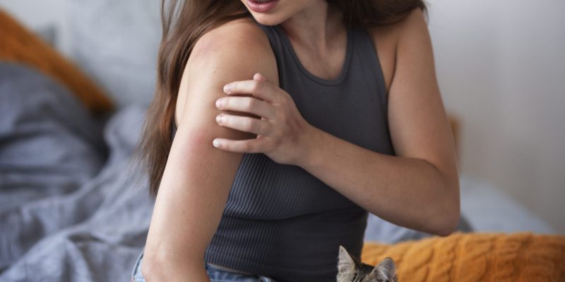 woman-suffering-from-rash woman-suffering-from-rash